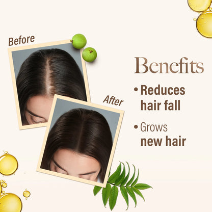 Huile Médicinale Ayurvédique Kesh King